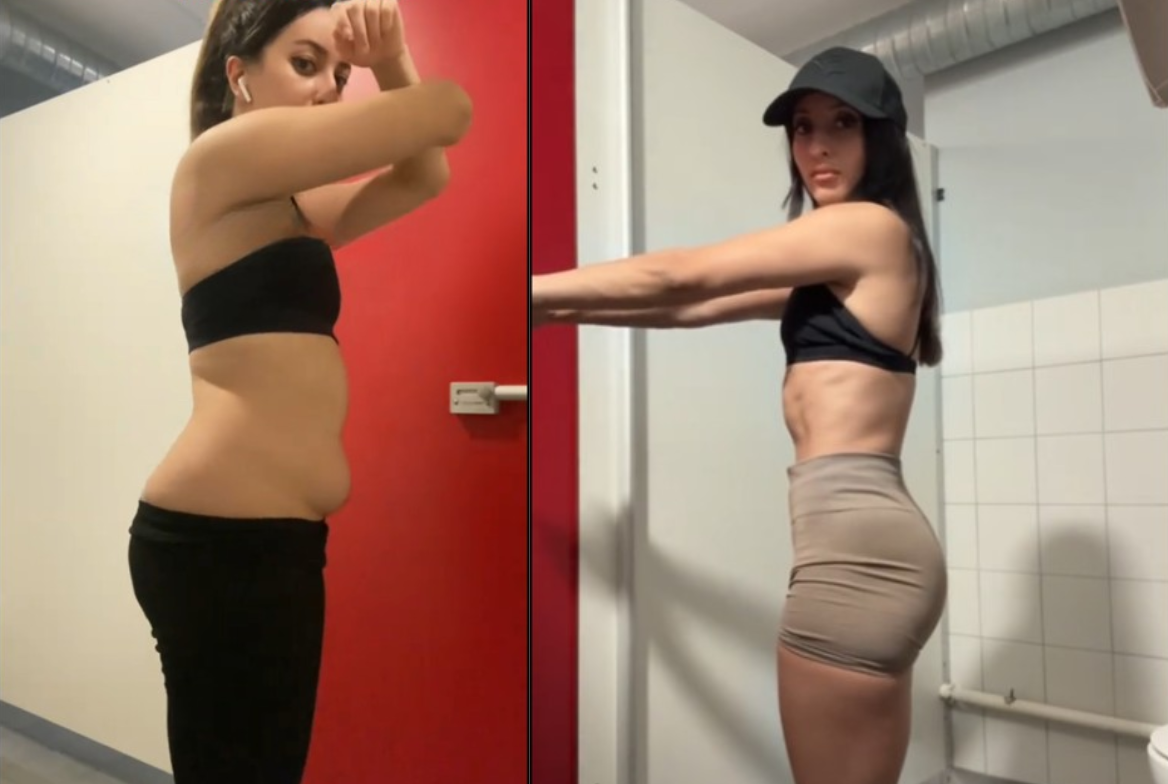Kayla B. before and after