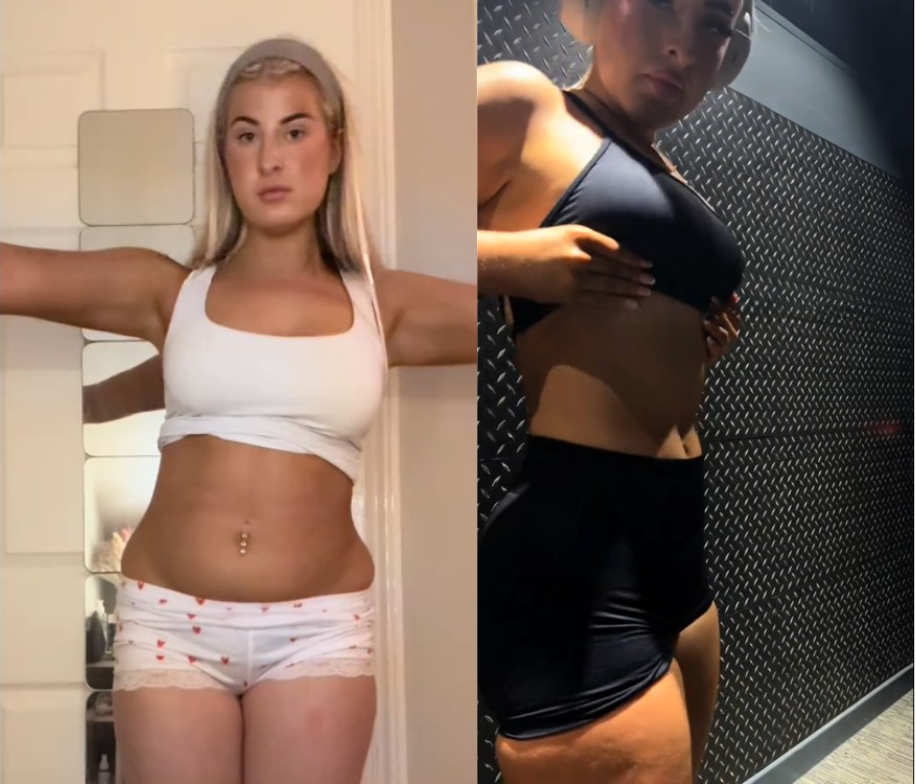 Jess W. before and after